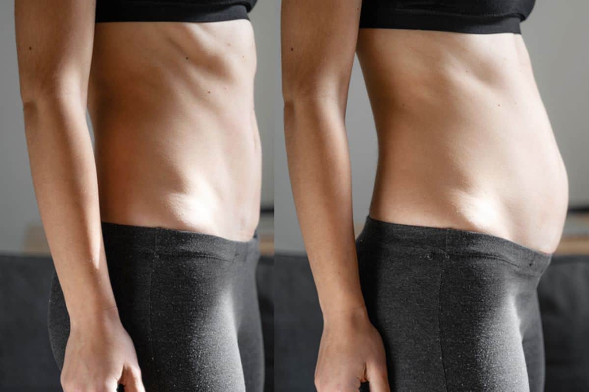 How long does diastasis recti take to improve Ponders End?