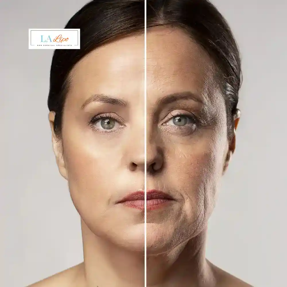 How Can You Tell If Non-Surgical Skin Tightening Is Right for You Ponders End?