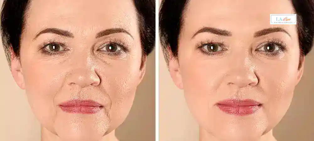 Why Aren’t My Skincare Products Making My Sagging Skin Look Firmer Ponders End?