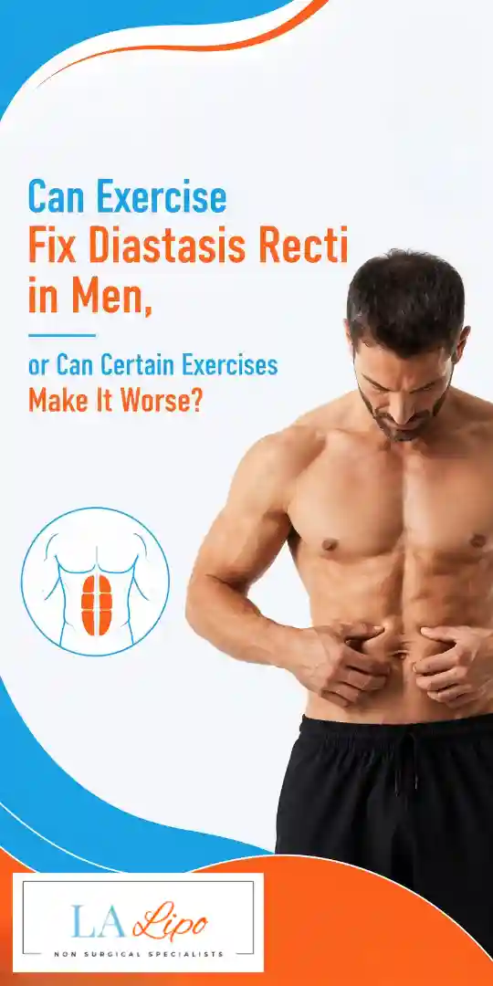 Can Exercise Fix Diastasis Recti in Men, or Can Certain Exercises Make It Worse Ponders End?